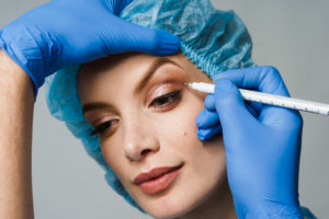 5 benefícios da cirurgia de pálpebras: o quinto é o nosso preferido!
